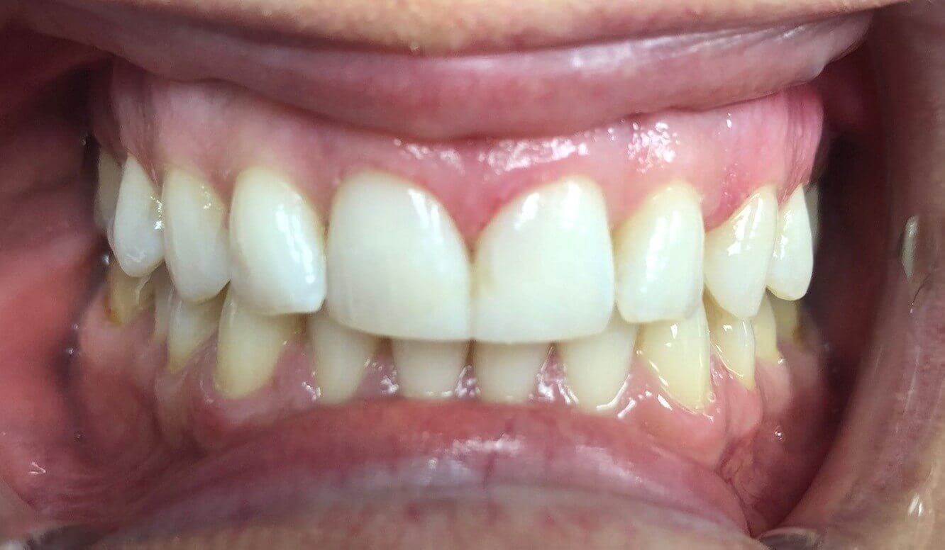 394856