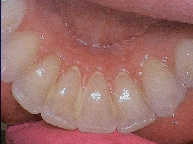 430929