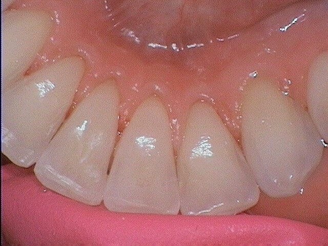 430930