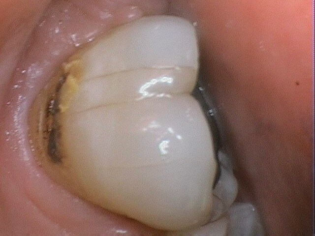 466441