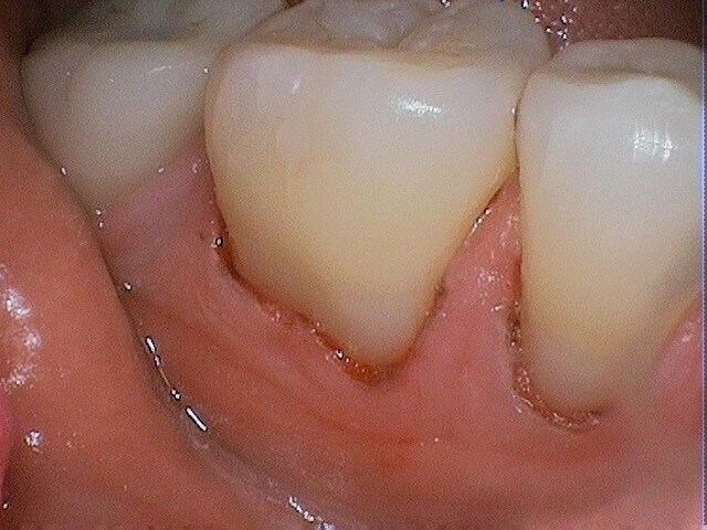 386299