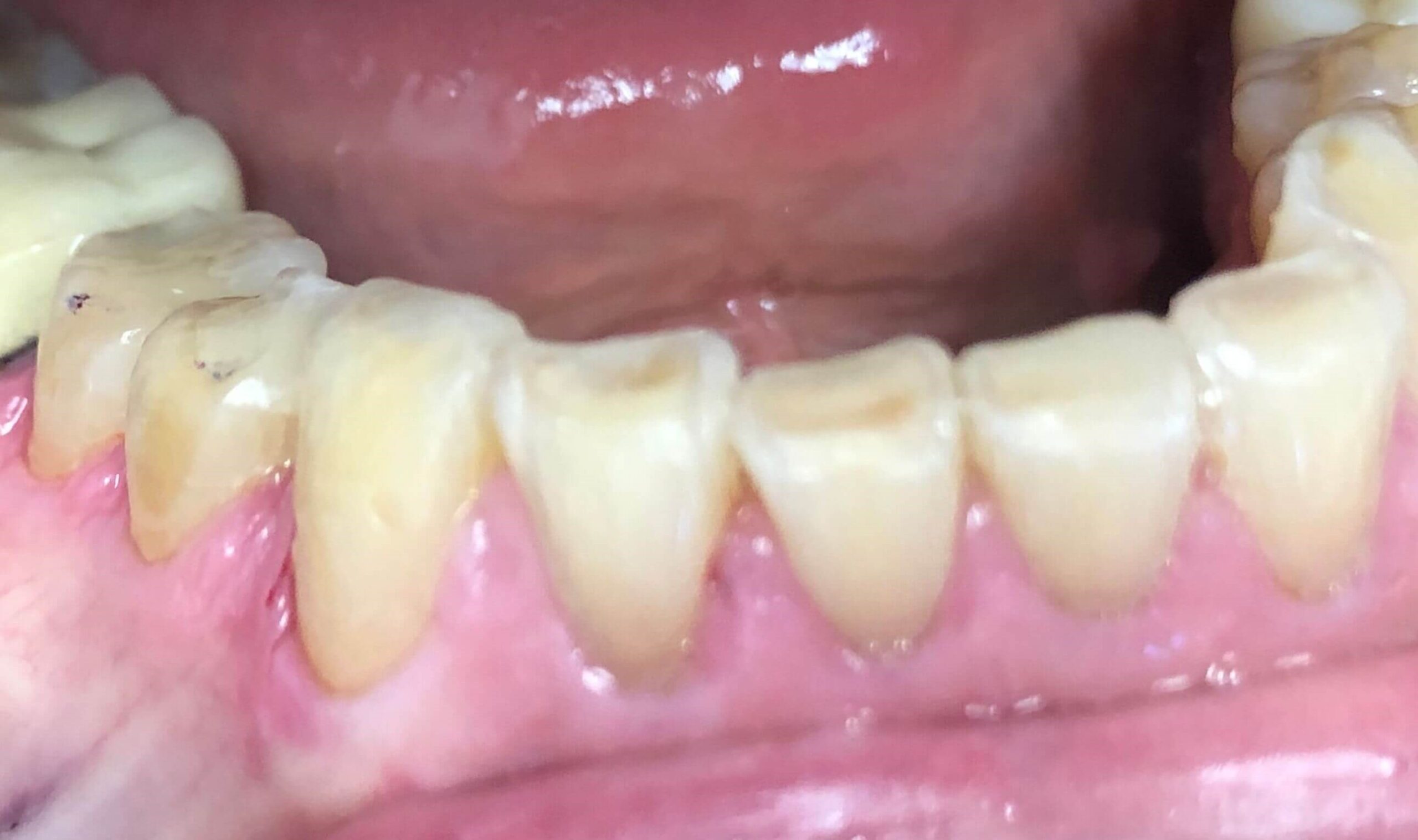 386673
