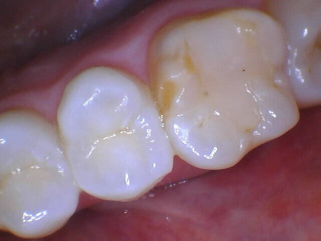 458376